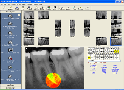 Radiographs are a part of your dental record.
