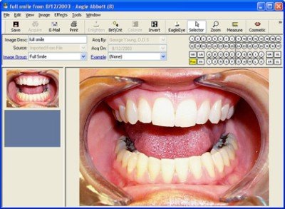 Electronic Health Records for the Dental Record.